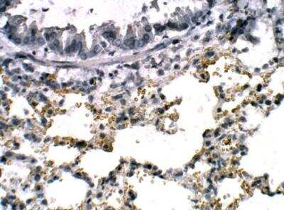 Immunohistochemistry-Paraffin: cGAS Antibody [NBP3-12371]