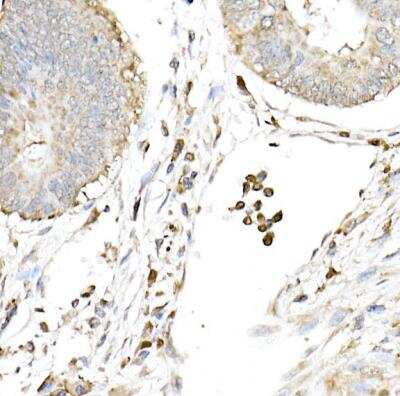 Immunohistochemistry-Paraffin: cGAS Antibody - BSA Free [NBP3-16666]