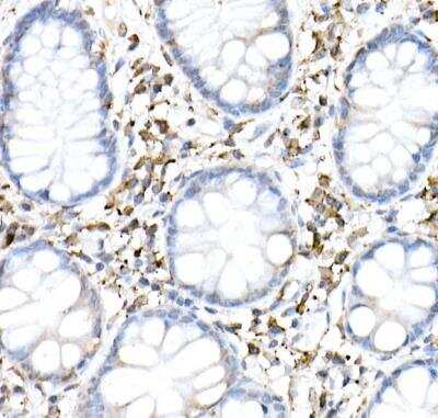 Immunohistochemistry-Paraffin: cGAS Antibody - BSA Free [NBP3-16666]