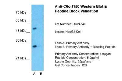 Western Blot: cGAS Antibody [NBP1-70755]