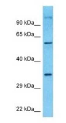 Western Blot: cGAS Antibody [NBP1-70755]
