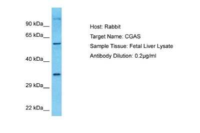 Western Blot: cGAS Antibody [NBP1-70755]