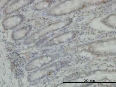 Immunohistochemistry-Paraffin: cGK1/PRKG1 Antibody (2B3) [H00005592-M03]