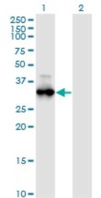 Western Blot: cGK1/PRKG1 Antibody (5E5) [H00005592-M01]