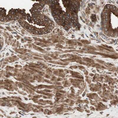 Immunohistochemistry-Paraffin: cGK1/PRKG1 Antibody [NBP1-87289]