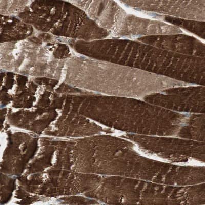 Immunohistochemistry-Paraffin: cGK1/PRKG1 Antibody [NBP1-87289]