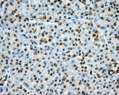 Immunohistochemistry: cGK1/PRKG1 Antibody (OTI9G4) - Azide and BSA Free [NBP2-71227]