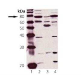 Western Blot: cGK1/PRKG1 Antibody [NBP2-14843]