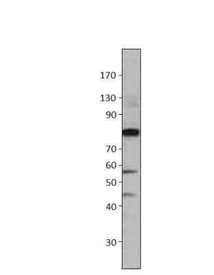 Western Blot: cGK1/PRKG1 Antibody [NBP3-12386]