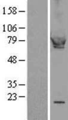 Western Blot: cGK1/PRKG1 Overexpression Lysate [NBL1-14782]