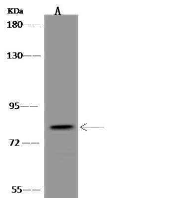 Western Blot: cGK2/PRKG2 Antibody [NBP3-05940]