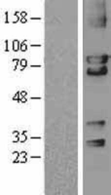 Western Blot: cGK2/PRKG2 Overexpression Lysate [NBL1-14783]