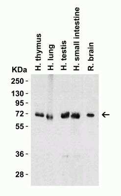 Western Blot: cIAP-1/HIAP-2 AntibodyBSA Free [NBP1-77193]