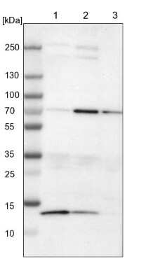 Western Blot: cIAP-1/HIAP-2 Antibody [NBP1-90133]