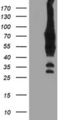 Western Blot: cIAP-2/HIAP-1 Antibody (OTI1A9) [NBP2-46576]