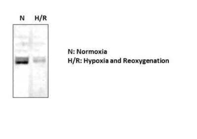 Western Blot: cIAP-2/HIAP-1 Antibody [NBP1-90132]