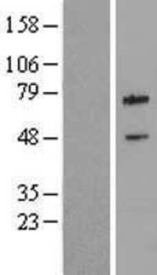 Western Blot: cIAP-2/HIAP-1 Overexpression Lysate [NBL1-07985]