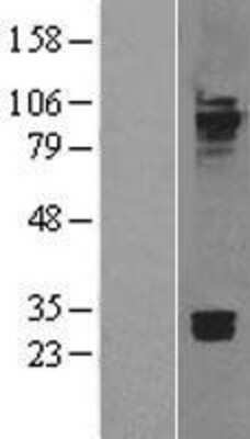 Western Blot: Cadherin-7 Overexpression Lysate [NBL1-09034]