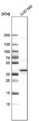 Western Blot: calcium homeostasis modulator 2 Antibody [NBP1-87936]