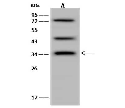 Western Blot: calcium homeostasis modulator 2 Antibody [NBP2-98589]