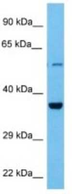 Western Blot: calcium homeostasis modulator 2 Antibody [NBP3-10852]