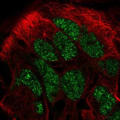 Immunocytochemistry/ Immunofluorescence: calmodulin-lysine N-methyltransferase Antibody [NBP2-57496]