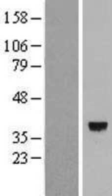 Western Blot: calmodulin-lysine N-methyltransferase Overexpression Lysate [NBL1-08411]