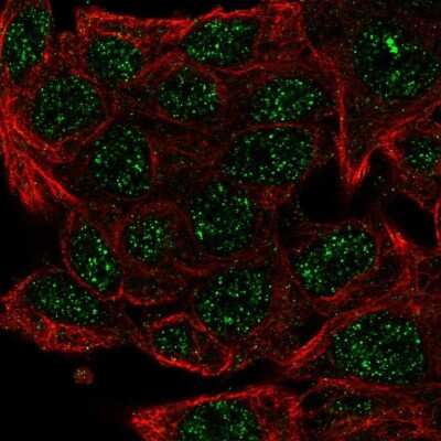 Immunocytochemistry/ Immunofluorescence: carabin Antibody [NBP2-49616]