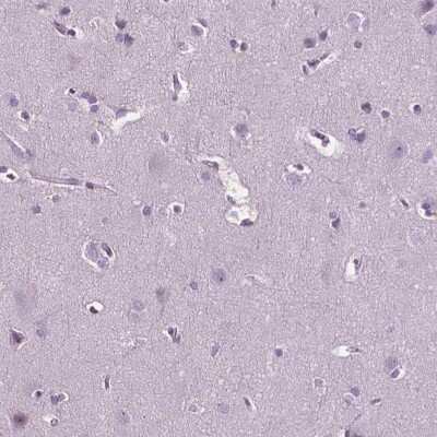 Immunohistochemistry-Paraffin: carabin Antibody [NBP2-49616]