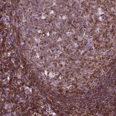 Immunohistochemistry-Paraffin: carabin Antibody [NBP2-49616]