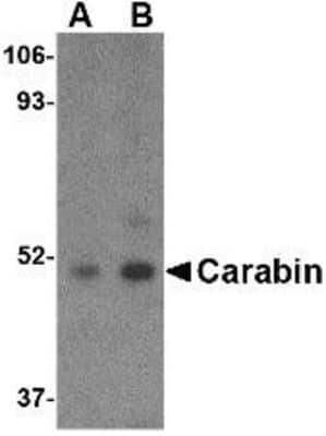 Western Blot: carabin AntibodyBSA Free [NBP1-76806]