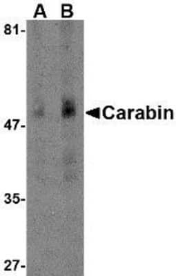 Western Blot: carabin AntibodyBSA Free [NBP1-76807]