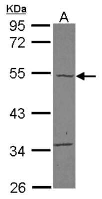 Western Blot: carabin Antibody [NBP2-15695]