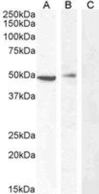 Western Blot: carabin Antibody [NBP2-76349]