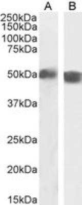 Western Blot: carabin Antibody [NBP2-76349]