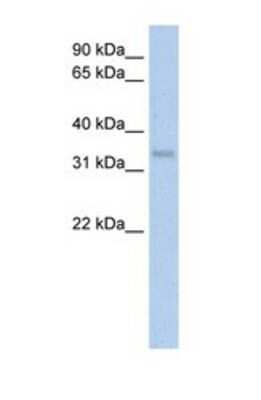 Western Blot: Carbonic Anhydrase IV/CA4 Antibody [NBP1-69373]