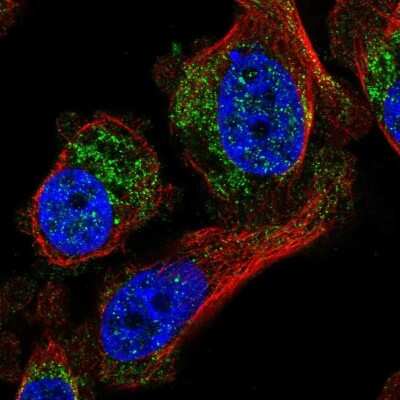 Immunocytochemistry/ Immunofluorescence: carboxylesterase 4A Antibody [NBP1-90638]