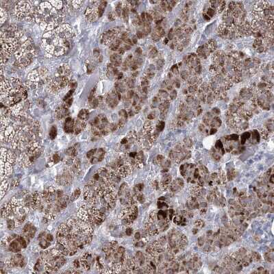 Immunohistochemistry-Paraffin: carboxylesterase 4A Antibody [NBP1-90638]