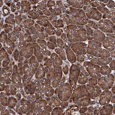 Immunohistochemistry: ch-TOG Antibody [NBP1-85625]