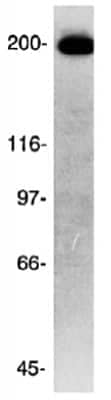 Western Blot: ch-TOG Antibody [NB500-182]