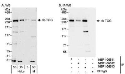 Western Blot: ch-TOG Antibody [NBP1-06513]