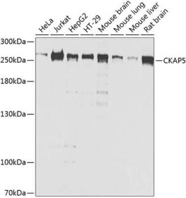 Western Blot: ch-TOG AntibodyBSA Free [NBP2-92555]