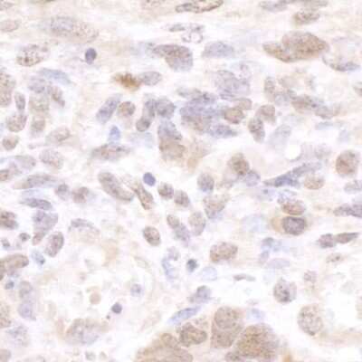 Immunohistochemistry-Paraffin: cleavage stimulation factor Antibody [NB100-60443]