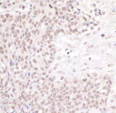 Immunohistochemistry-Paraffin: cleavage stimulation factor Antibody [NB100-60443]