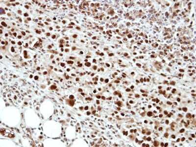 Immunohistochemistry-Paraffin: cleavage stimulation factor Antibody [NBP2-15913]