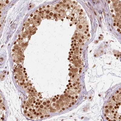 Immunohistochemistry-Paraffin: cleavage stimulation factor Antibody [NBP2-33486]