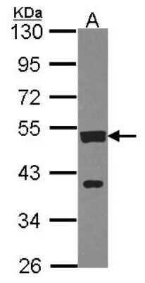 Western Blot: cleavage stimulation factor Antibody [NBP2-15913]