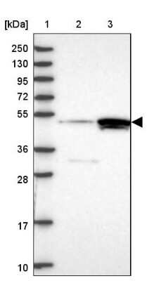 Western Blot: cleavage stimulation factor Antibody [NBP2-33486]