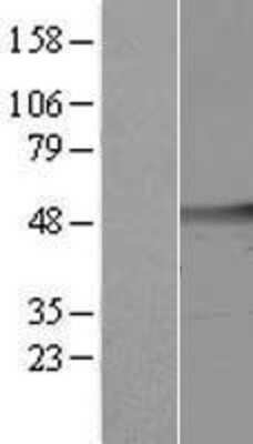 Western Blot: cleavage stimulation factor Overexpression Lysate [NBL1-09555]