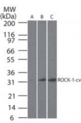 Western Blot: ROCK1 Antibody (12M03) [NBP1-46006]